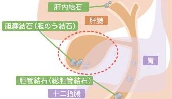 入院生活その４ 手術準備編