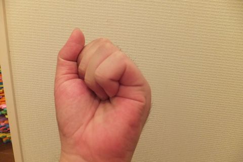 骨折完治！