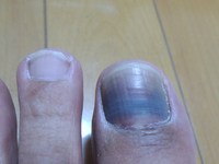 衣替え